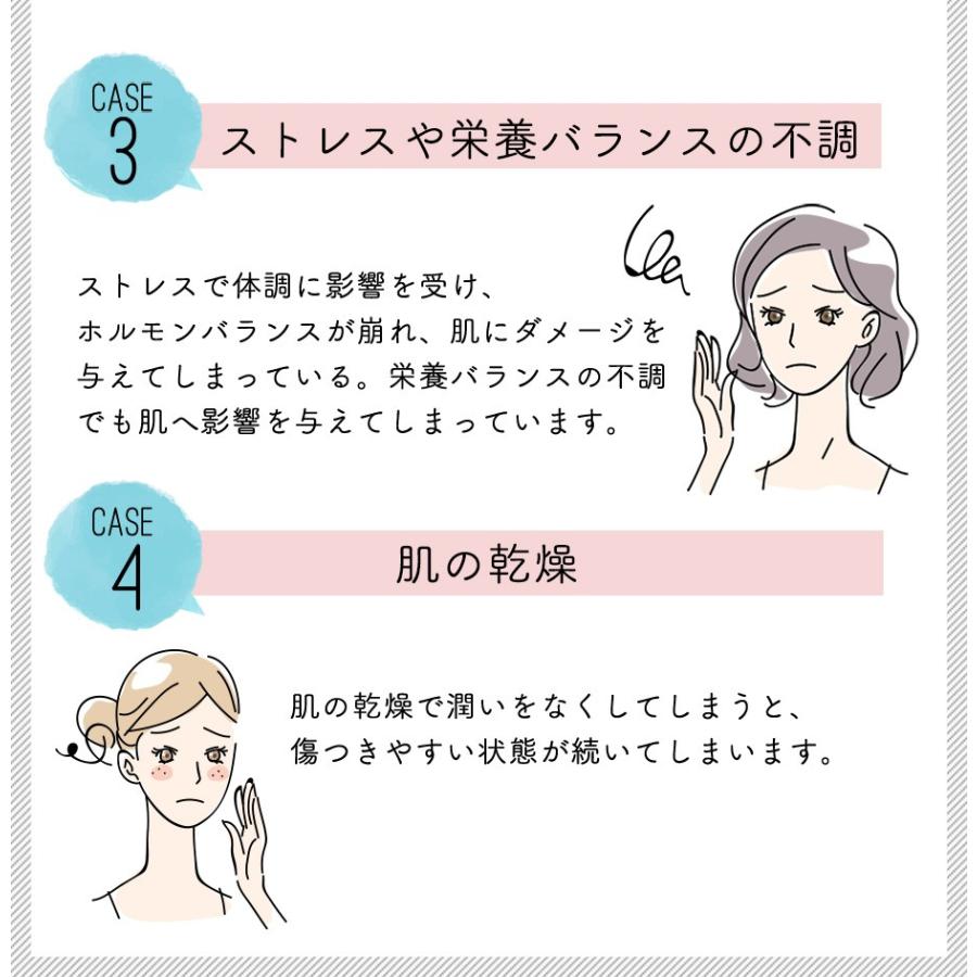 S Fit ホワイトニングクリーム 黒ずみ デリケートゾーン 乳首 ピンク Vio 肌 肌荒れ ひざ くろずみ 医薬部外品 30g 10000028 アクアビット 通販 Yahoo ショッピング