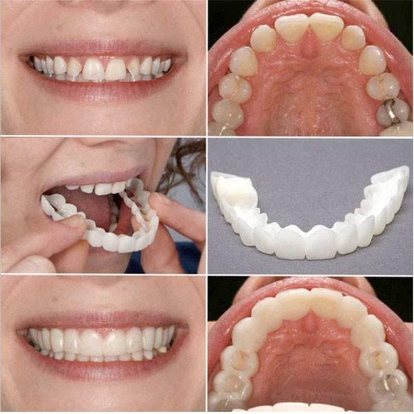 リモート ハロウィン きれいな歯にみせる 歯並び マウスピース かぶせ カバー インスタントブレイス Wilcon Com Pe