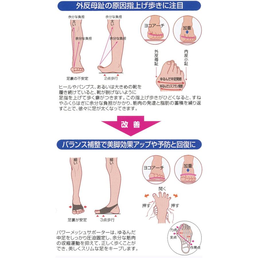 外反母趾グッズ ソルボ パワーメッシュ 固定型（外反母趾 内反小趾 サポーター）｜actika｜04