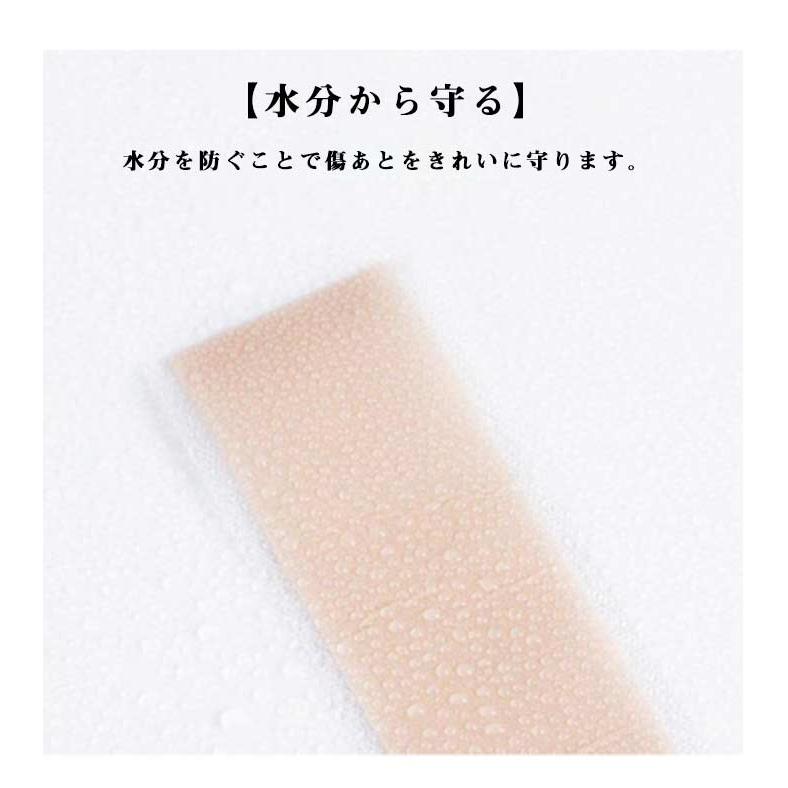 傷あとケアテープ 帝王切開 傷跡ケアテープ ケロイド テープ 貼り心地にもこだわった 傷あとケア用シリコンジェルシート 手術後 帝王切開 シリコンテー |  | 07