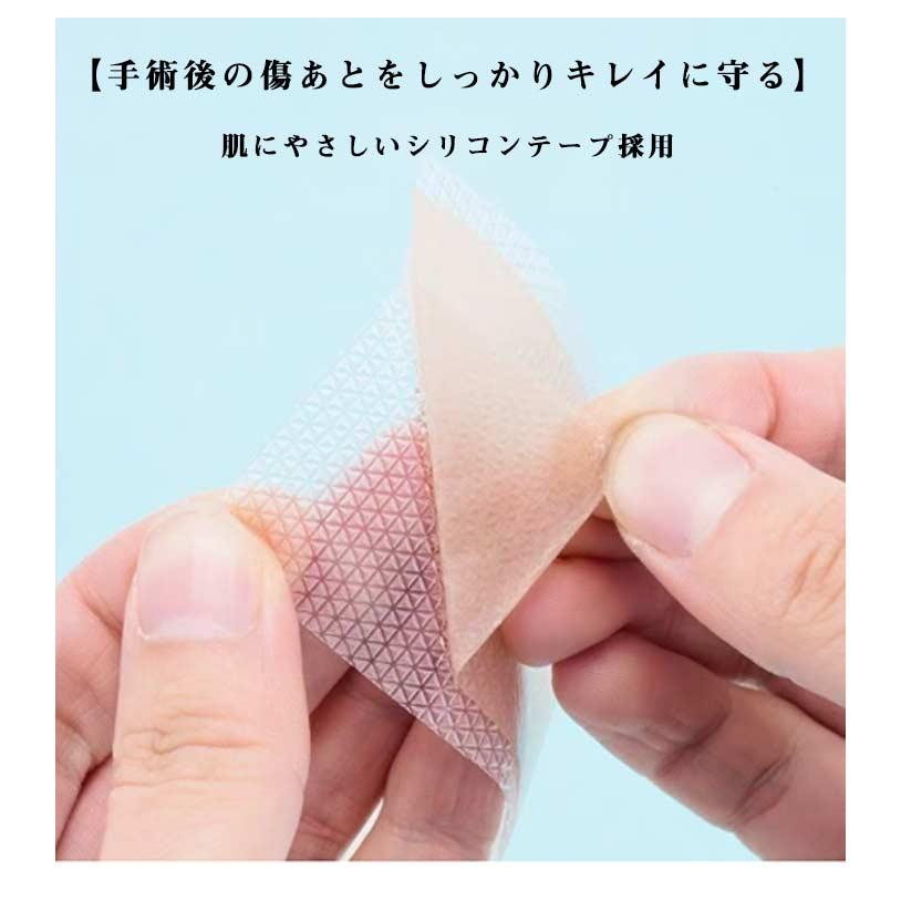 傷あとケアテープ 帝王切開 傷跡ケアテープ ケロイド テープ 貼り心地にもこだわった 傷あとケア用シリコンジェルシート 手術後 帝王切開 シリコンテー |  | 08