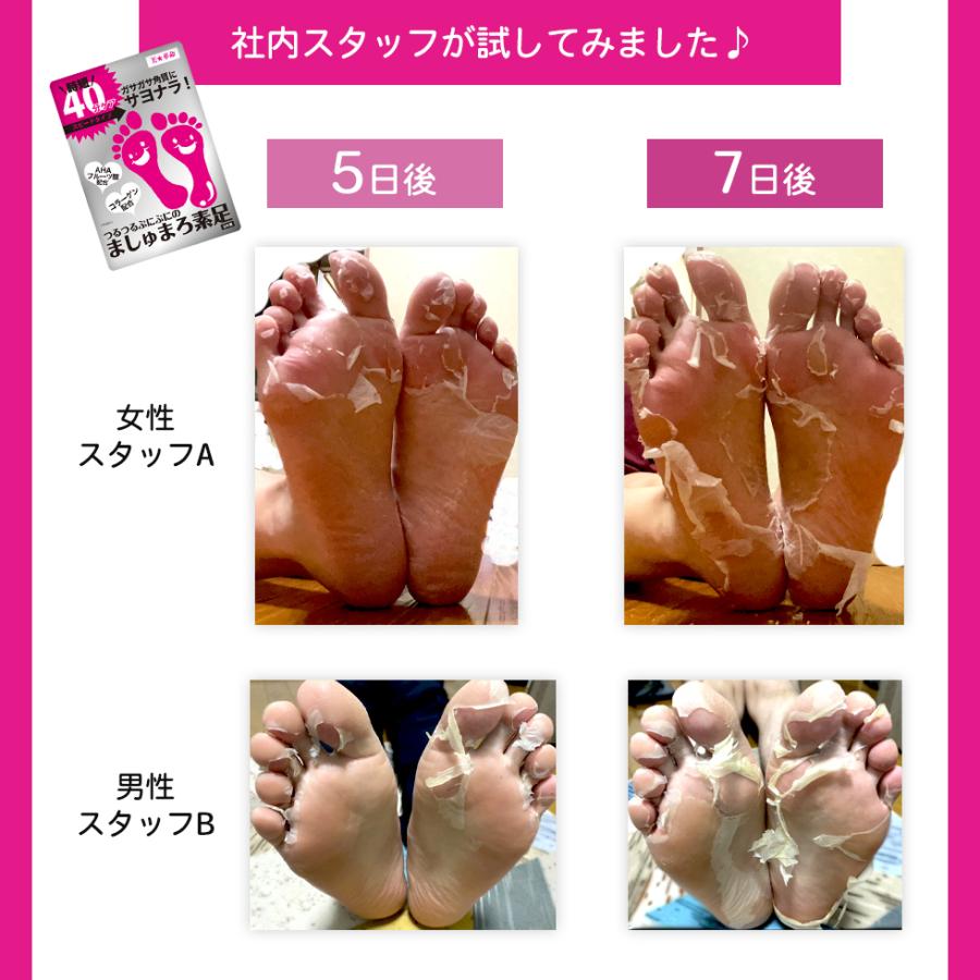 足 裏 角質 パック