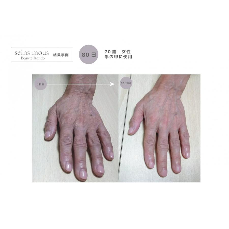 Seins Mous 【セインムー】ボーテロンド30ml @cosmeで1位獲得！【当店