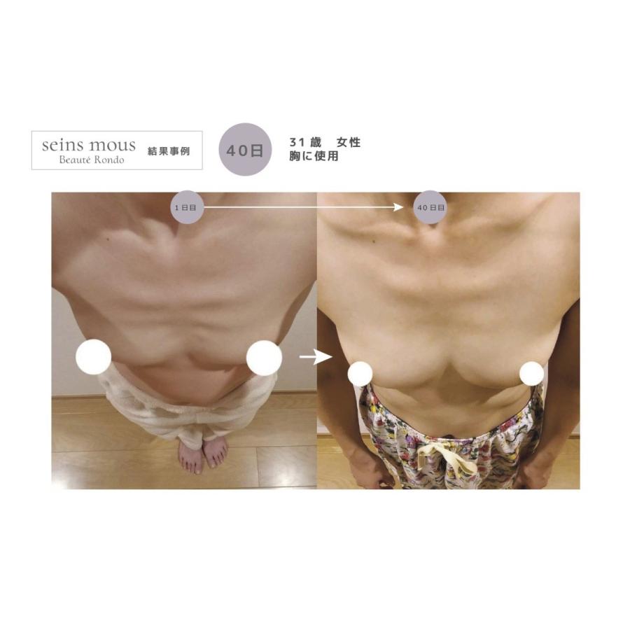 Seins Mous 【セインムー】ボーテロンド30ml @cosmeで1位獲得！【当店