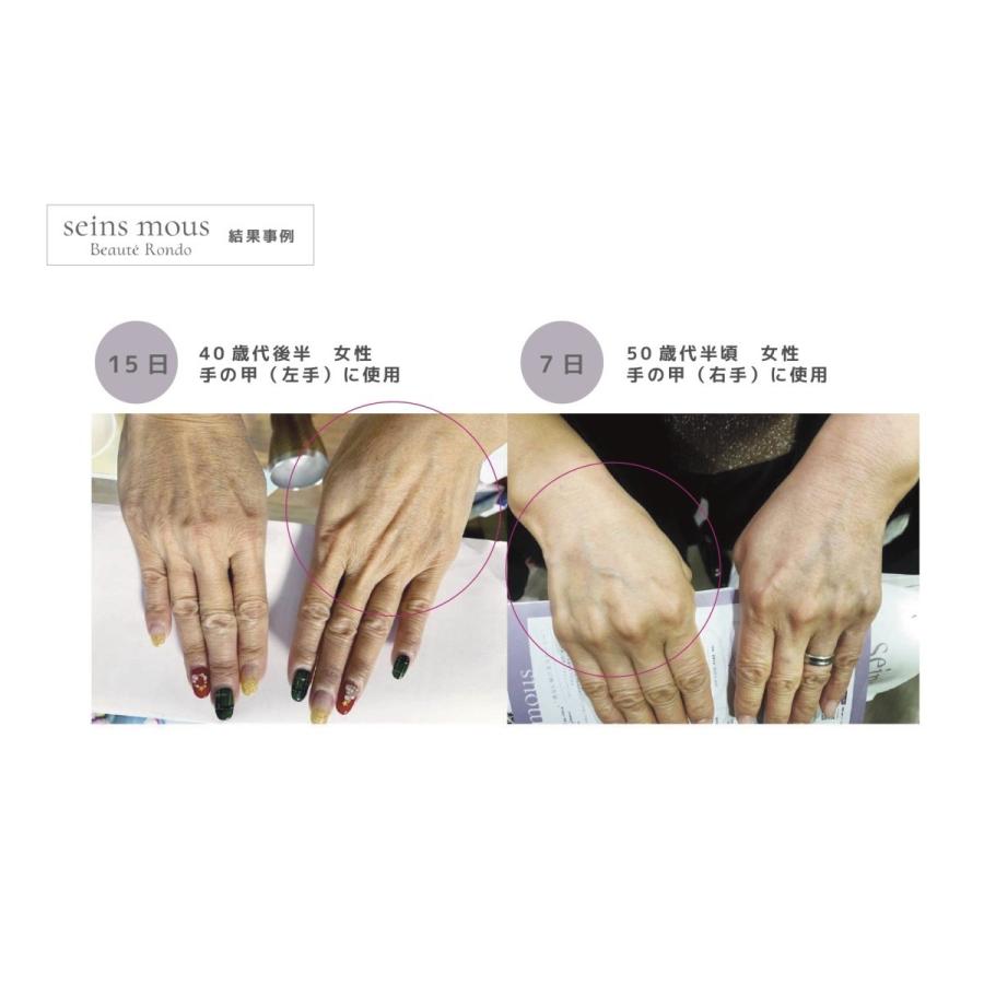 Seins Mous 【セインムー】ボーテロンド30ml @cosmeで1位獲得！【当店