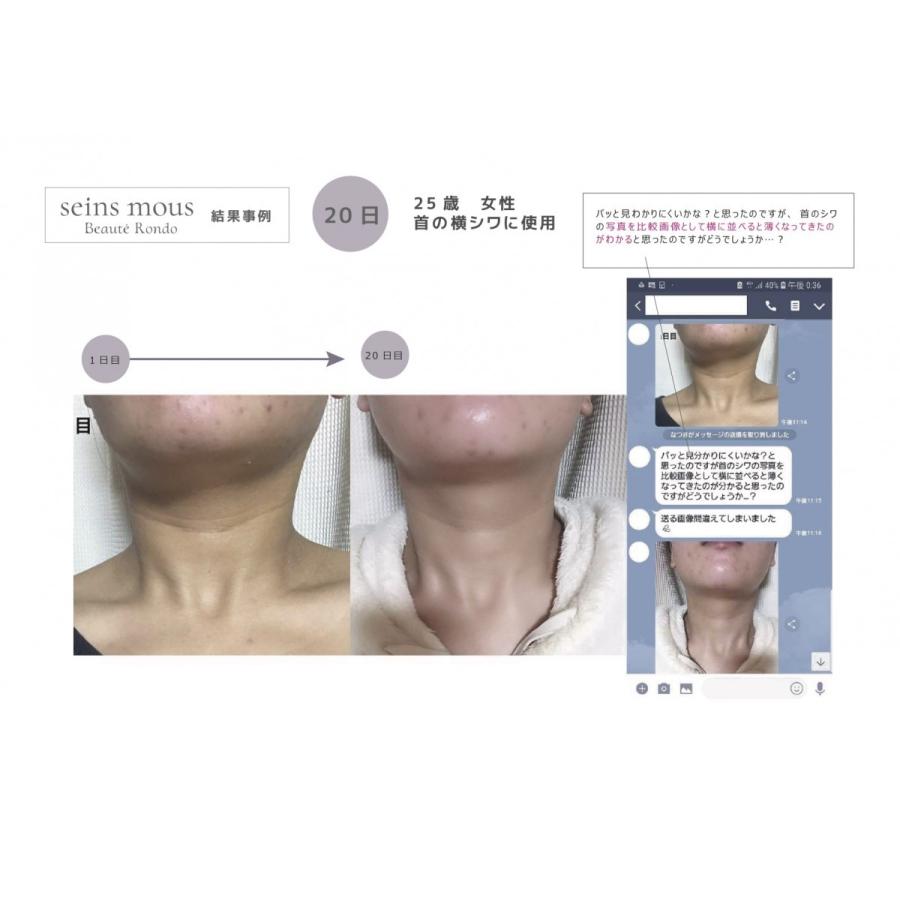 Seins Mous 【セインムー】ボーテロンド30ml @cosmeで1位獲得！【当店