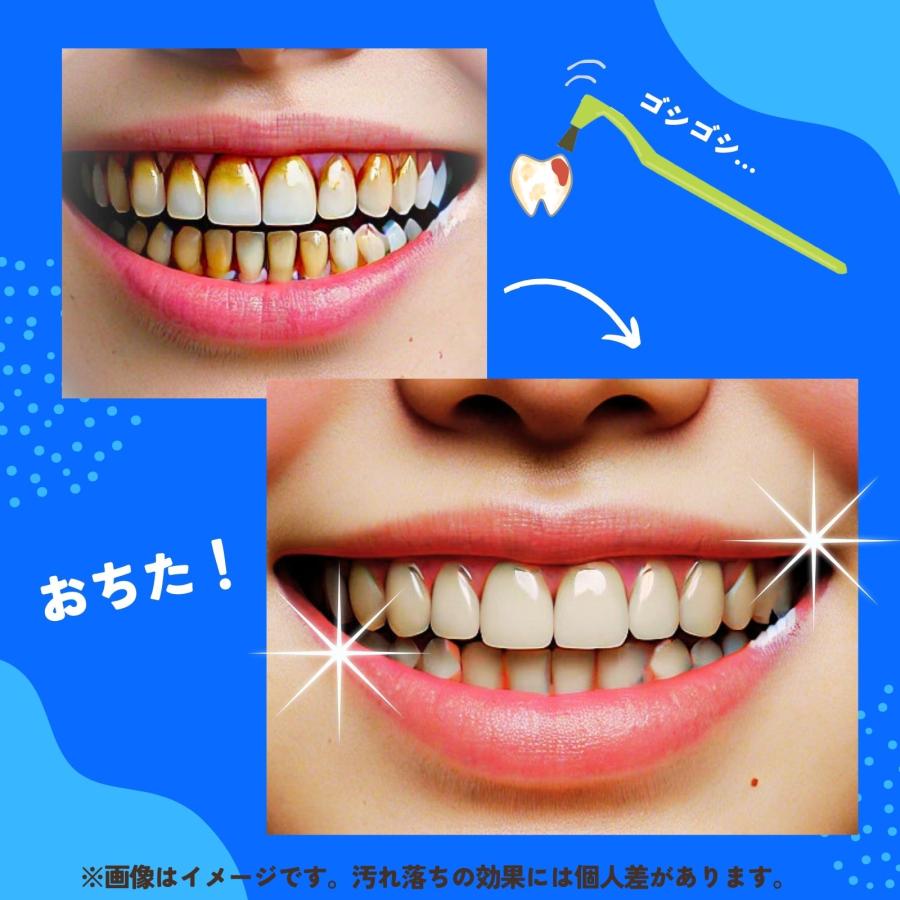 ホワイトニング 歯を白く 歯 ヤニ 黄ばみ 消しゴム 3本セット！歯の消しゴム オーラルケア ヤニ取り ステインバスター  ステイン除去 |  | 05