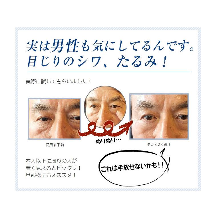 ダルダルの目元が見違える 目の下 シワ消し 目元改善 シワに効く たるみ 小じわ 簡単しわ取り 気になる目の下 エイジフレックス No 480 Bm0010 Advanced Base 通販 Yahoo ショッピング