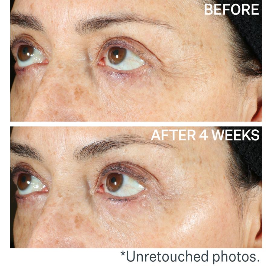 StriVectinストリベクチン ペプタイト タイトニングネックセラムローラー StriVectinストリベクチン ペプタイト タイトニングネックセラム