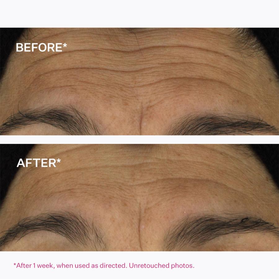 ストリベクチン アンチリンクル トランスフォームセラム 30ml (美容液) もちもち ふっくら 変化 やわ肌 ハリ ツヤ キメ エイジングケア |  | 04