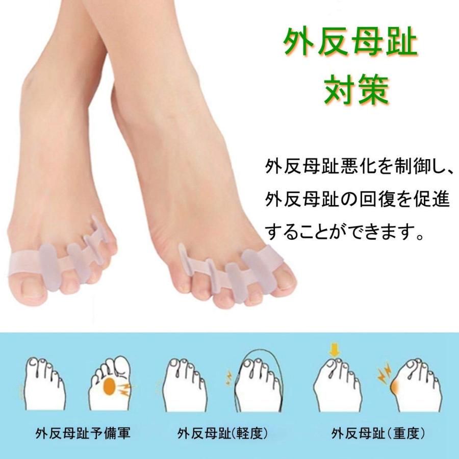 外反母趾 サポーター Lbotoo 足指美人 足の痛みを軽減 足指矯正パッド 指間広げる 浮き指 シリコン製 男女兼用 5本指タイプ 左右セット 08 071 アドヴァンストア 通販 Yahoo ショッピング