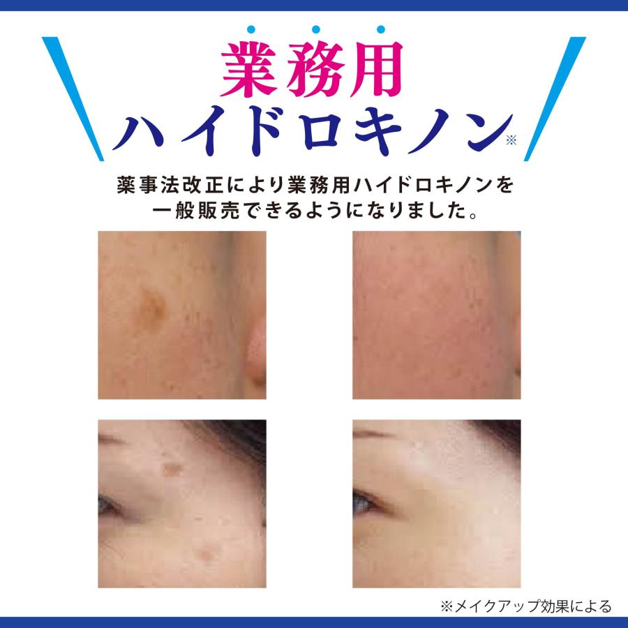 純ハイドロキノン 5％ クリームタイプ 15g 旭研 ハイドロキノン