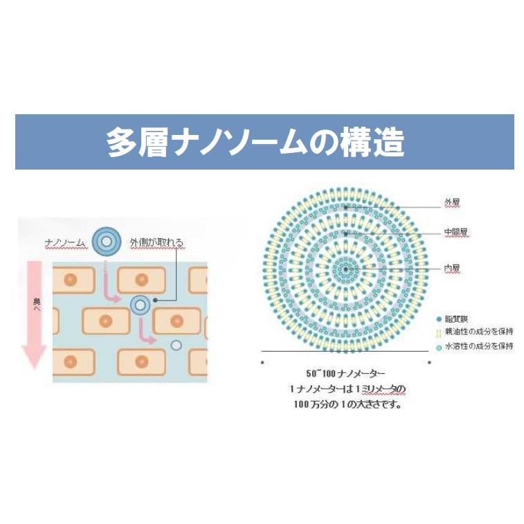 イオンボディ ピュアキュア PureCure ヒト幹細胞培養液 20ml 4本