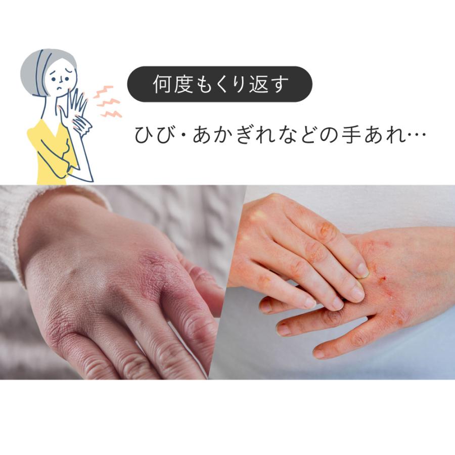 ハンドクリーム 手荒れ ひび あかぎれ 肌荒れ 精油香る 薬用ハンドクリーム  エイジングケア ギフトやプレゼントに ポイント利用 爆買 母の日 | ILUS | 10