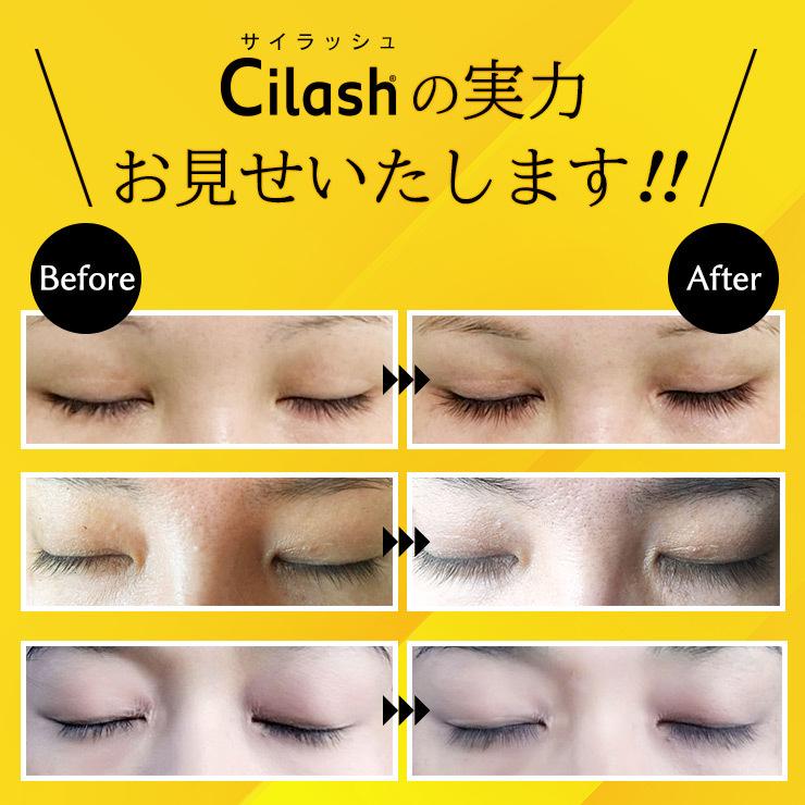 レビューを書いて半額返金！】まつ毛美容液 + 眉毛美容液 サイラッシュ
