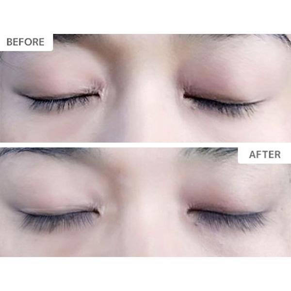 まつ毛美容液 エックスエックスラッシーズ Xxlashes 3ml Sale まつ育 まつ毛 睫毛 まつ毛ケア マツ育 Xxlashes Eyelushserum 3ml Ahcスイス 通販 Yahoo ショッピング