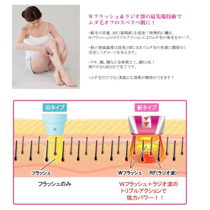 脱毛器 ワイドフラッシュアクセラレーションRF : エイムストア