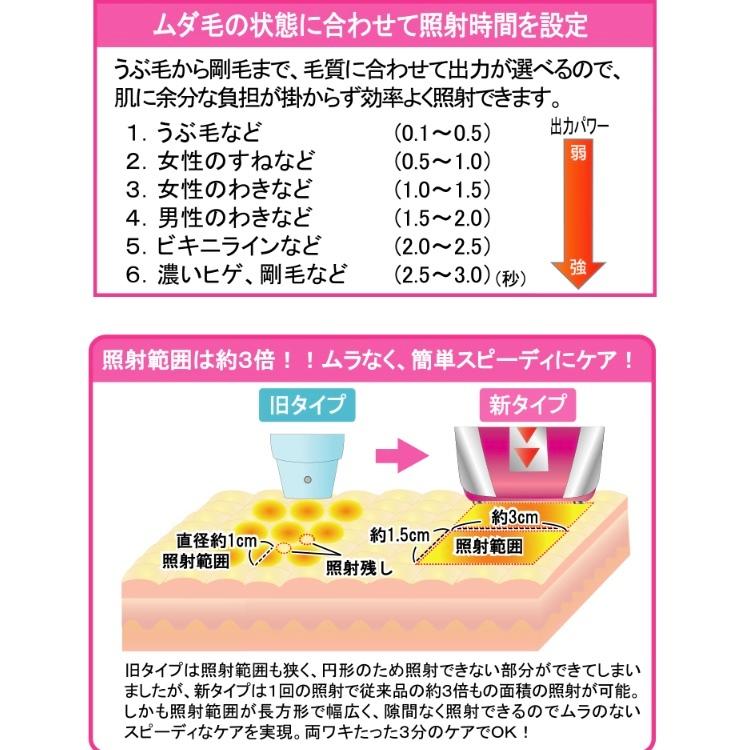 脱毛器　ワイドフラッシュアクセラレーションRF |  | 02