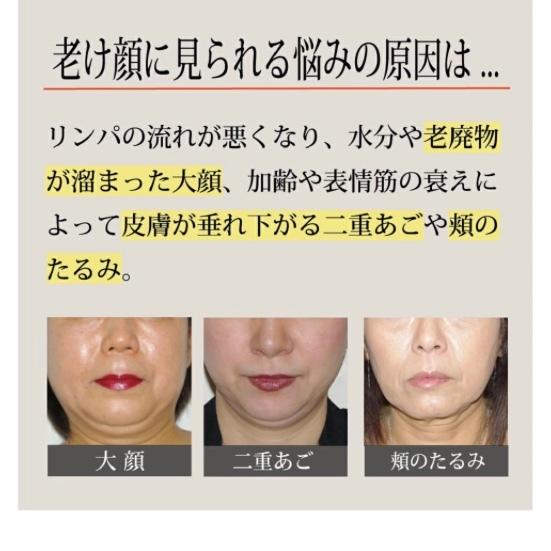 美顔器 フェイスラックイージー フェイスライン 二重あご 老廃物
