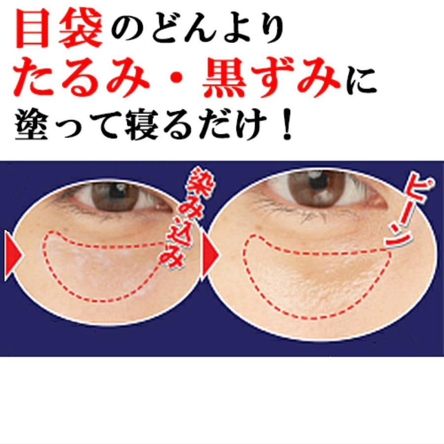 マイノロジ 3個セット 目元用クリームパック メブネールEX 30g 目袋