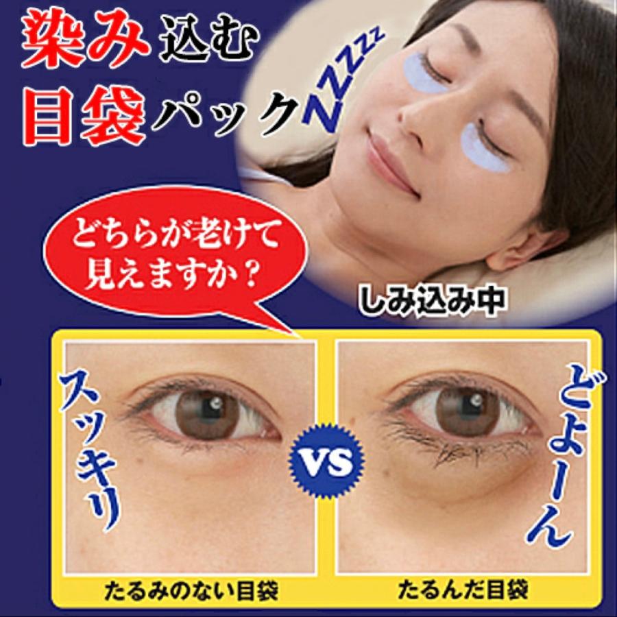 目元用クリームパック メブネールEX 30g 目袋ケア たるみ クリーム 