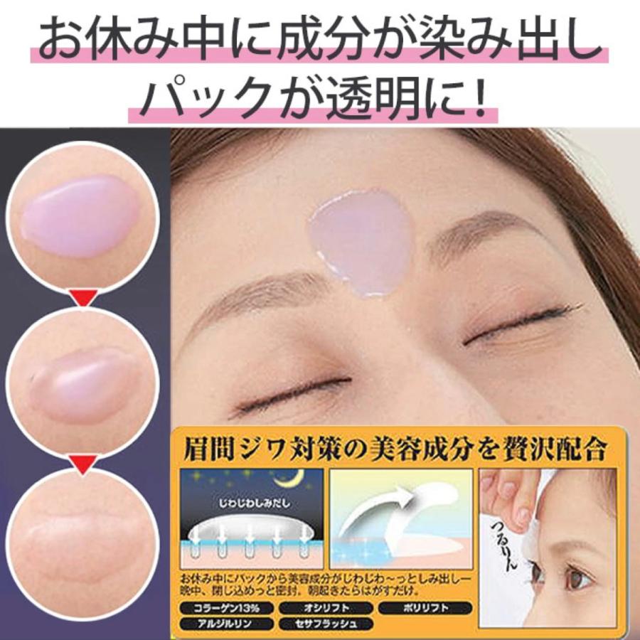 眉間 の シワ 改善
