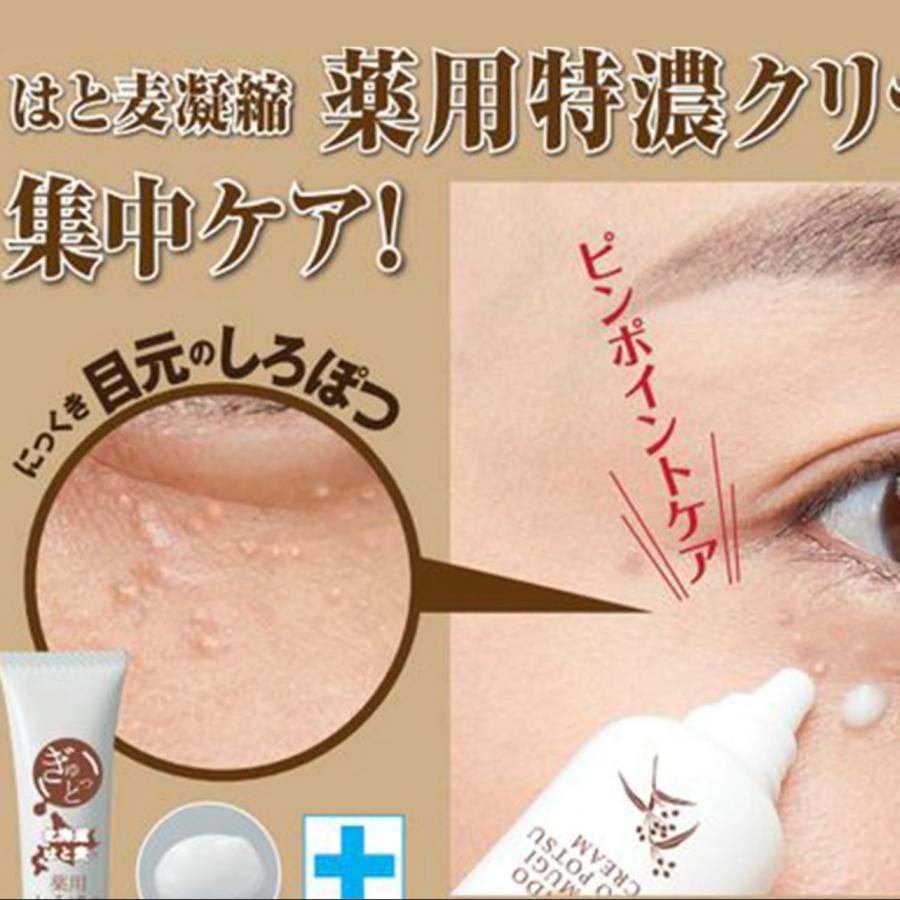 マイノロジ 目の周りのポツポツケア 薬用しろぽつクリーム 15g 白い