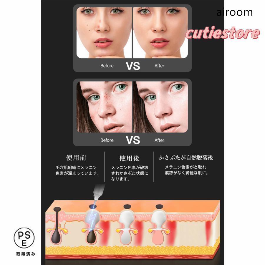 お肌の気になる部分をなんとかしたい！低周波美顔機シミ取りホクロ取り新品未使用 2025年最新】低周波シミ取りの人気アイテム - メルカリ