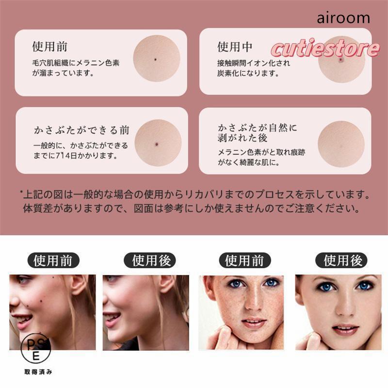 レーザーペン レーザースポットペン レーザー除去ペン 9階段