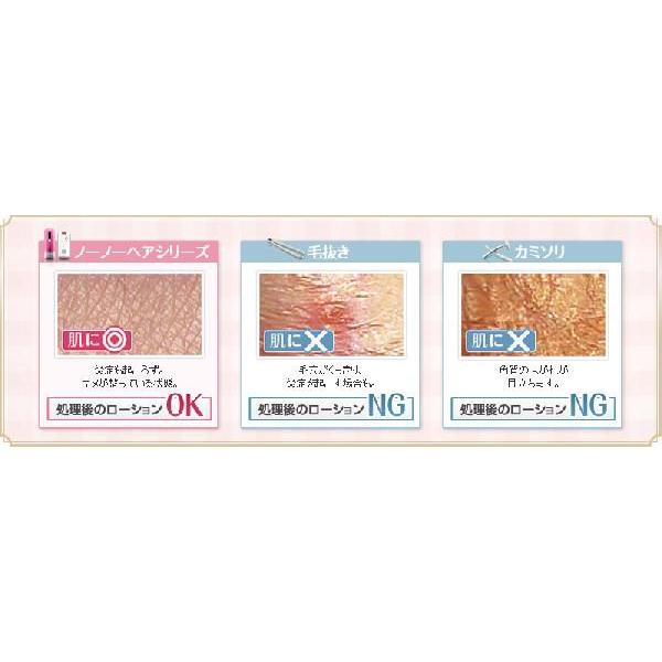ノーノーヘアースマート no!no!HAIR SMART（ノーノーヘアー スマート）販売サイト