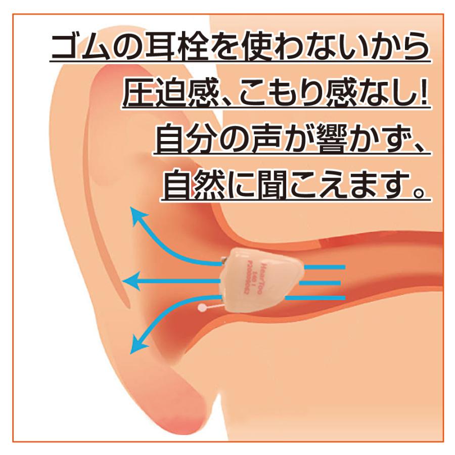 耳あな型デジタル補聴器 アクトスITC HT-140 片耳用 軽等度〜中度後半