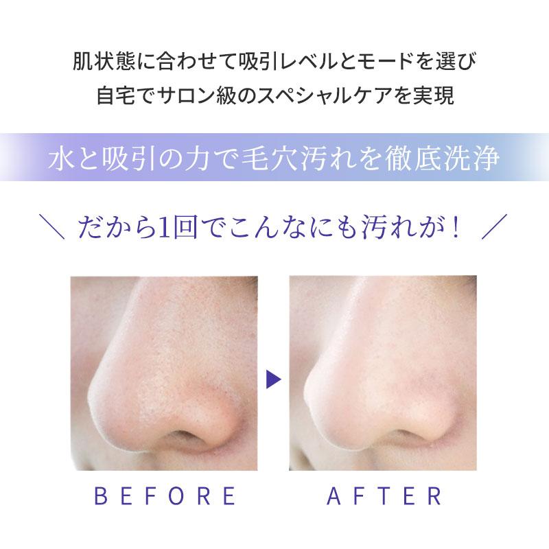 NIPLUX ニップラックス 毛穴吸引器 マルチスキンクリーナー 真空