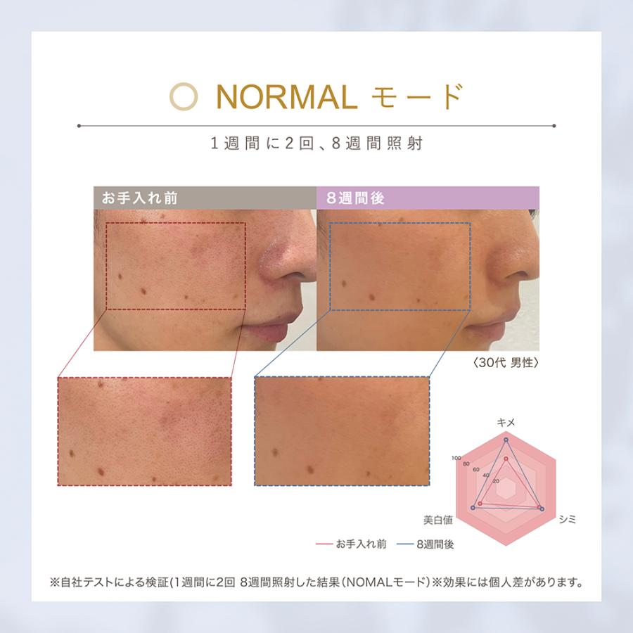 LINKA 美顔器 光美容器 リンカ スノー フラッシュ DPL/NIR ブライト