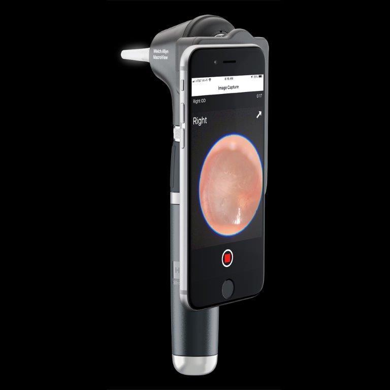 ウェルチ・アレン 耳鏡ヘッドWelchAllynウェルチアレン_新マクロビュー