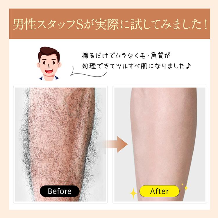 脱毛器 メンズ 女性 擦るだけ ガラス ナノガラス ナノガラス脱毛