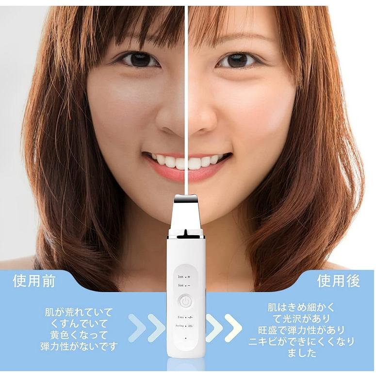 最終値下げ！アデランス 肌の美容 ピーリング 【公式通販】