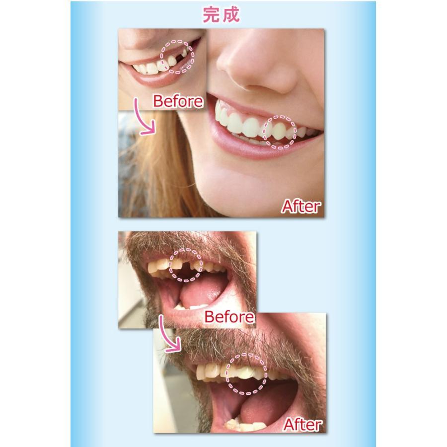 本物・正規品 義歯 仮歯 インスタントスマイル テンポラリートゥース