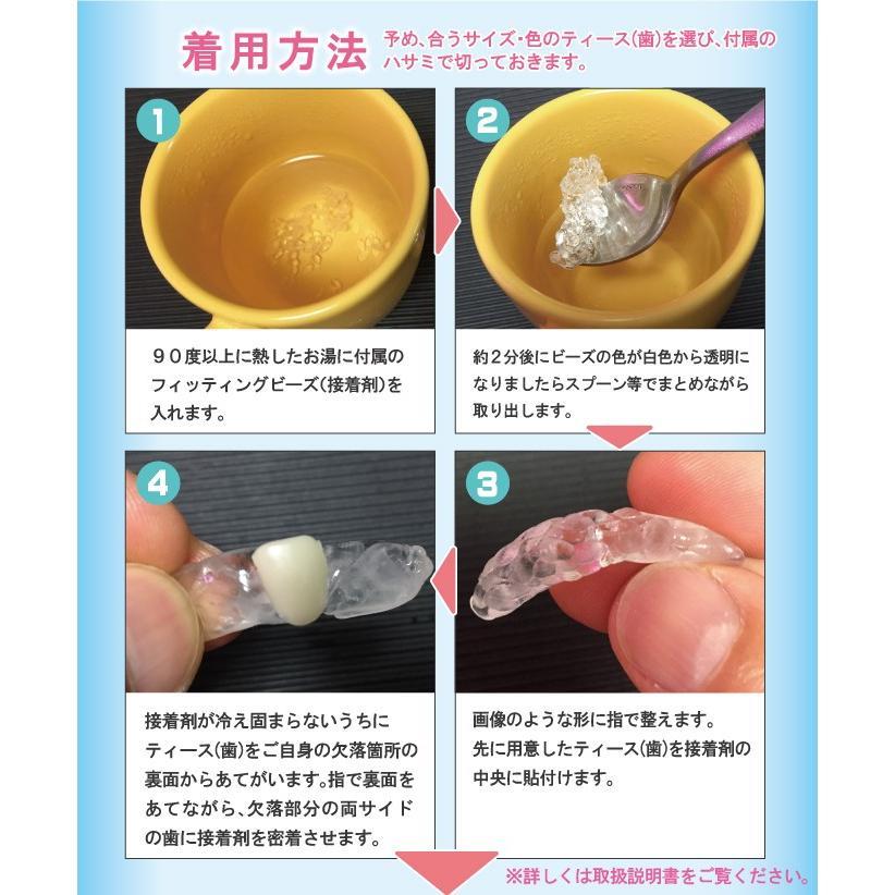 本物・正規品 義歯 仮歯 インスタントスマイル テンポラリートゥース