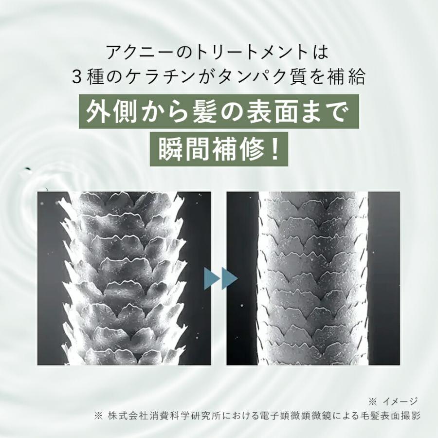 楽天ランキング1位】【累計200万個突破】 AKNIR アクニー 梨花 薬用