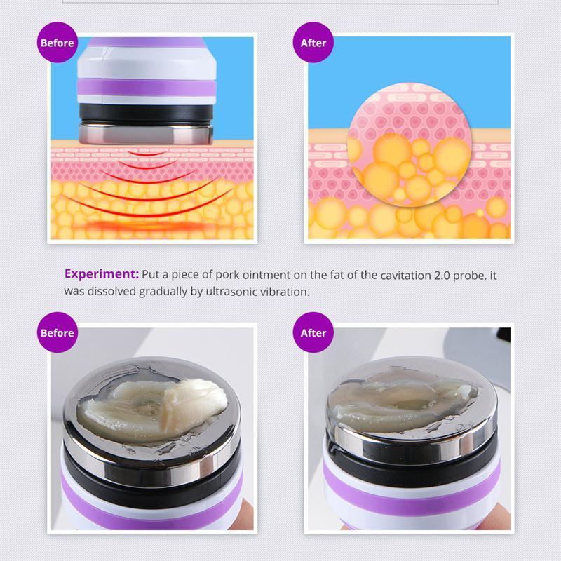 キャビテーションマシン ラジオ波 RF 温熱ケア 美容器 業務用 家庭用 1台5役エステマシン 顔用 体用 バキューム吸引機能付 複合美容機器     商品情報    1.業務用レベルエステマシンを基にしてデザインされていて、ご自宅でも業務用レベルのスキンケア・シェイプ