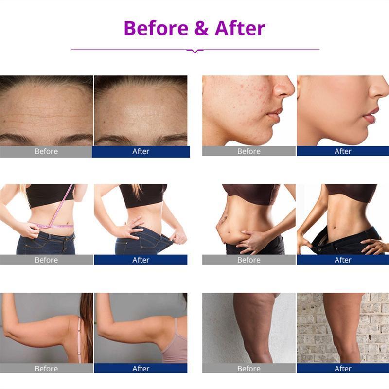 キャビテーションマシン ラジオ波 RF 温熱ケア 美容器 業務用 家庭用 1台5役エステマシン 顔用 体用 バキューム吸引機能付 複合美容機器     商品情報    1.業務用レベルエステマシンを基にしてデザインされていて、ご自宅でも業務用レベルのスキンケア・シェイプ