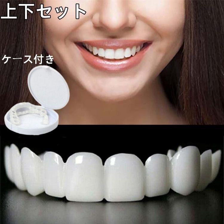 即納 2個セット 入れ歯 歯にかぶせる 歯 カバー 上下セット 付け歯