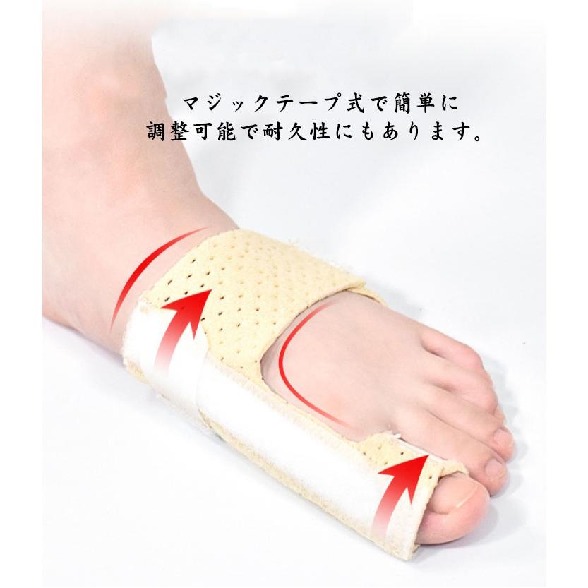 足指骨折サポーター 外反母趾 二重アルミ板 親指専用 リハビリ 足指