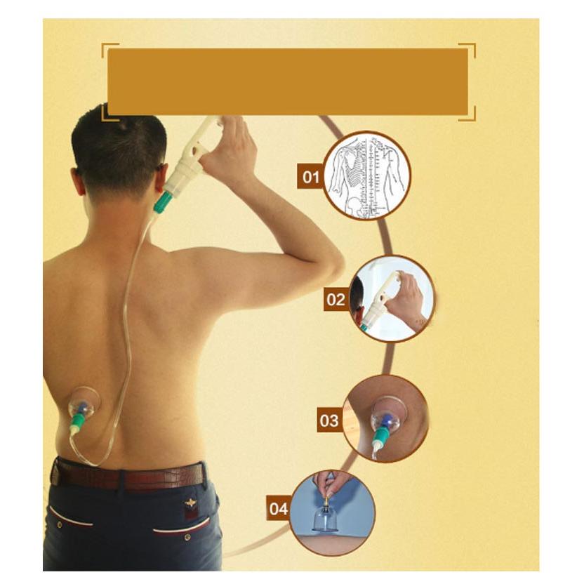 カッピング 吸玉 吸い玉 ハンド 真空ポンプ Q 吸引器 ハンドポンプ1個＋吸い玉カップ12個 セット カッピング 吸玉