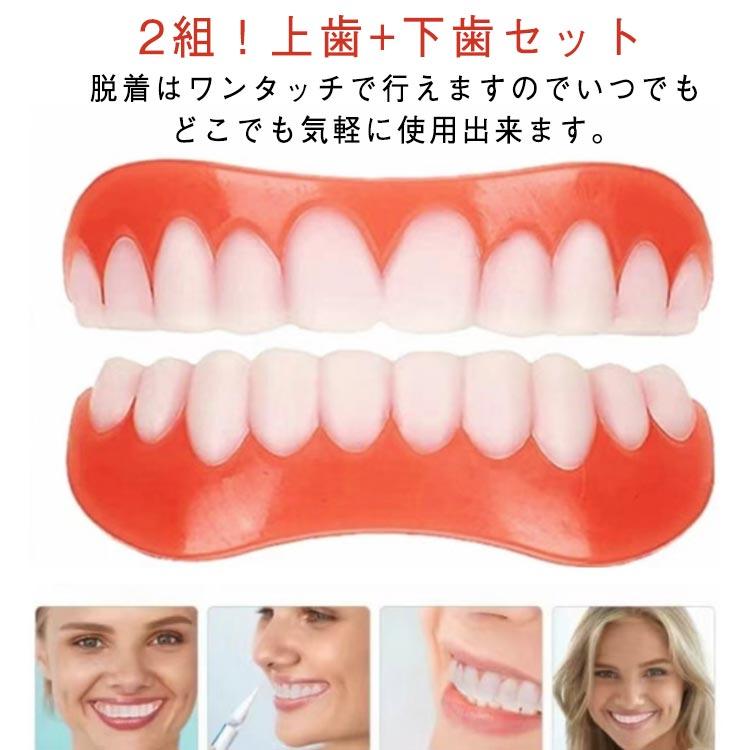 2組上下セット 仮歯 パーフェクトスマイル 下歯 歯のホワイトニング