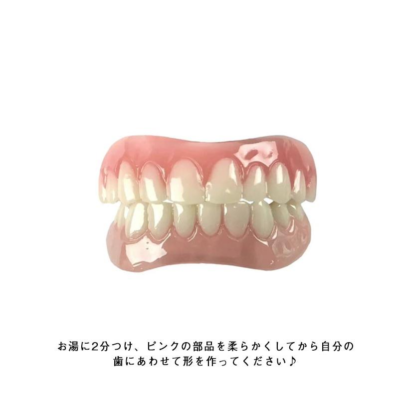 2組上下セット 仮歯 パーフェクトスマイル 下歯 歯のホワイトニング