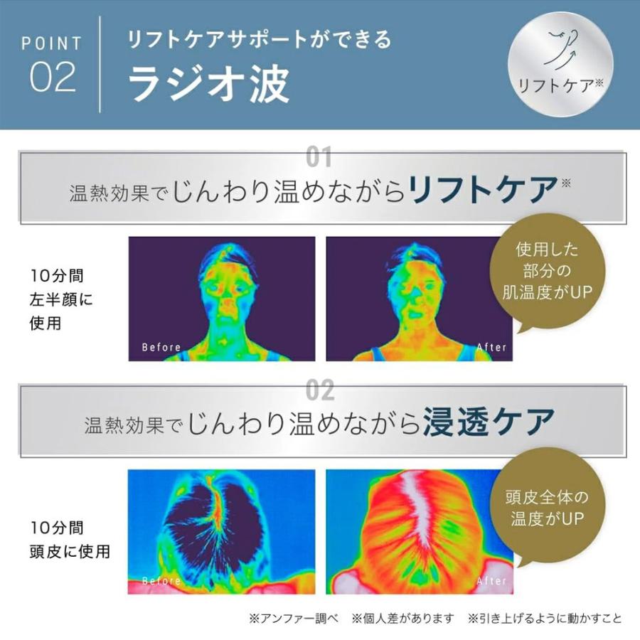 スカルプD ボーテ 即納 医師監修 ANGFA アンファー スカルプ電気