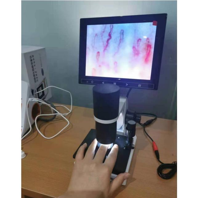 観察 血流スコープ◆毛細血管 顕微鏡 YASHIMA (八洲光学工業) Cマウント 同軸落射照明装置 TS-93002-CII E1765102760(15623円)