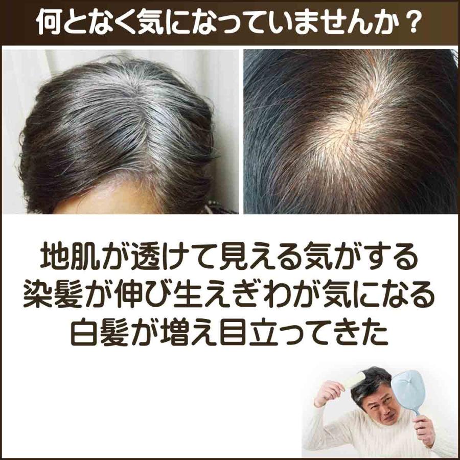 白髪隠し 薄毛隠し ファンデーション パウダー 簡単 手軽 ポンポン 容器 白髪染め 薄毛 白髪かくし 女性用 男性用 ハゲ隠し 対策 隠す ファンデ 頭皮 白髪 Gj Hirfund アリージェム 通販 Yahoo ショッピング