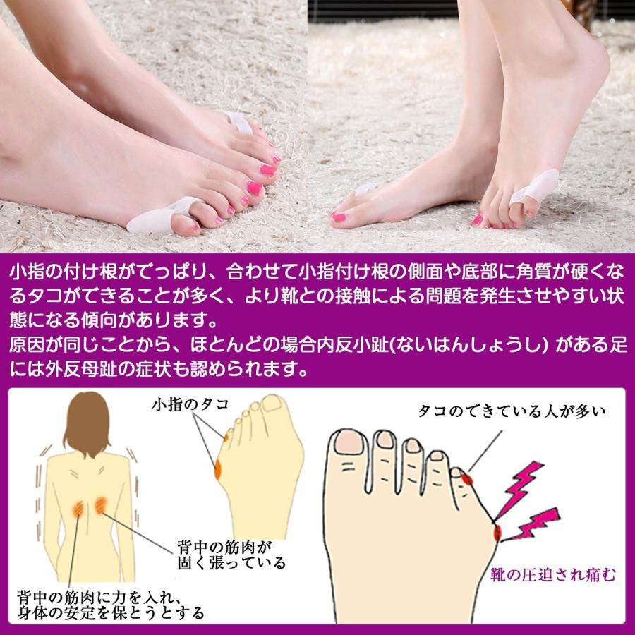 Amaritu 健康 内反小趾用4個セットamp 最新 超 気持ちいい 買物 矯正パッド 靴ズレ防止ジェルパッド グッズ 予防矯正 足指広げケア